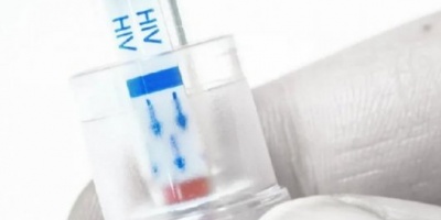 Laboratorio argentino lanzó un nuevo medicamento para tratar el VIH