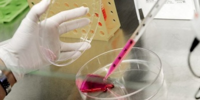 Avanza el desarrollo de un test para detectar cáncer de mama y de próstata en forma precoz